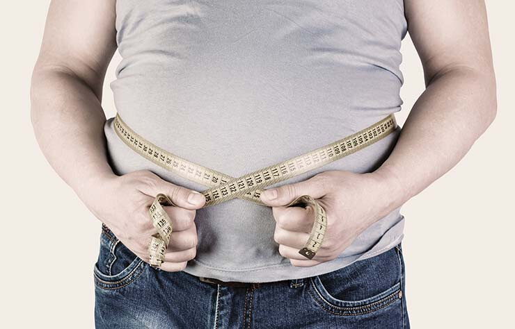 Hämorriden Risikogruppe Übergewicht